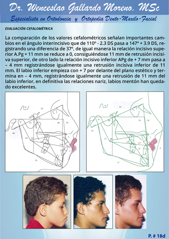 dental-detist-ortodoncia-guayaquil